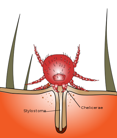 How to Treat Chigger Bites-What Are They