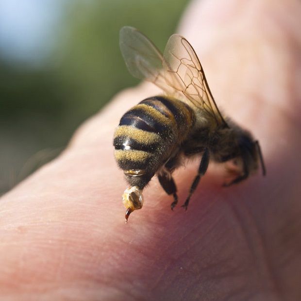 Bee Sting Reactions