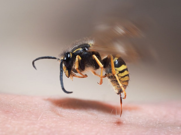 What Are the Symptoms of a Bee Sting?
