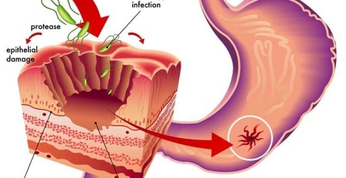 Diagram showing the structure of a gallbladder (gastrointestinal tract)